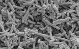 E. coli bacteria