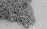 fibroblast cells