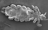 head louse