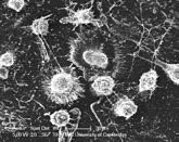 human monocyte