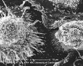 human monocyte