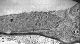 Preparation of  ASM