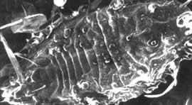 Scanning micrograph of aphid