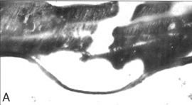 Preparation of ASM