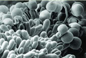 Pollen of Cactus Zygocactus Truncatus