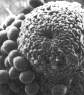 Critical Point Drying - Bacteria