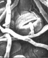 Critical Point Drying - Mildew