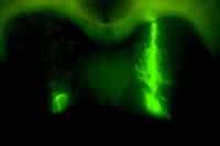 Mouse Brain with EGFP-tagged lentovirus vector