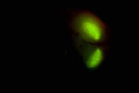 GFP-labeled dorsal striatum