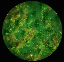 GFP-labeled dorsal striatum