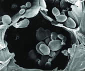 Starch Grains in Potato