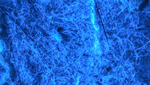 ultraviolet