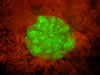 Coral Recruitment