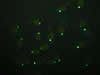 Zebrafish embryos – lhx1a-GFP © Charles Mazel
