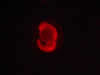 Zebrafish embryo – Ubi dTomato © Charles Mazel
