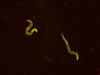 YFP C. elegans. © NIGHTSEA/Charles Mazel
