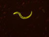 YFP C. elegans. © NIGHTSEA/Charles Mazel
