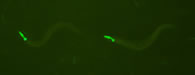 GFP C. elegans. © NIGHTSEA/Charles Mazel