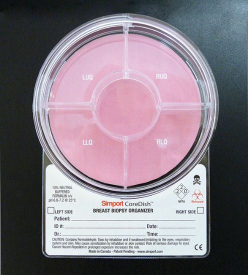 Picture of Breast, 5 Compartments