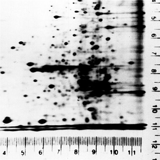 Picture of Autoradiography Ruler
