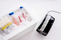 Transparent cryogenic labels