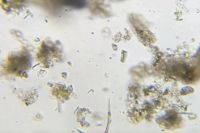 99225_micrograph_1.jpg