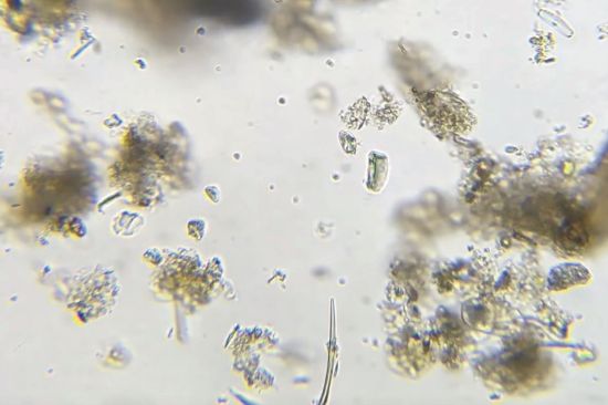 Em1 Portable Microscope