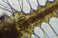 99225_micrograph_3.jpg