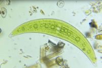 99225_micrograph_4.jpg