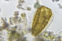99225_micrograph_5.jpg