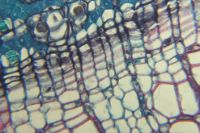 99225_micrograph_6.jpg