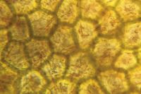 99225_micrograph_7.jpg