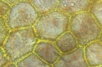 99225_micrograph_8.jpg